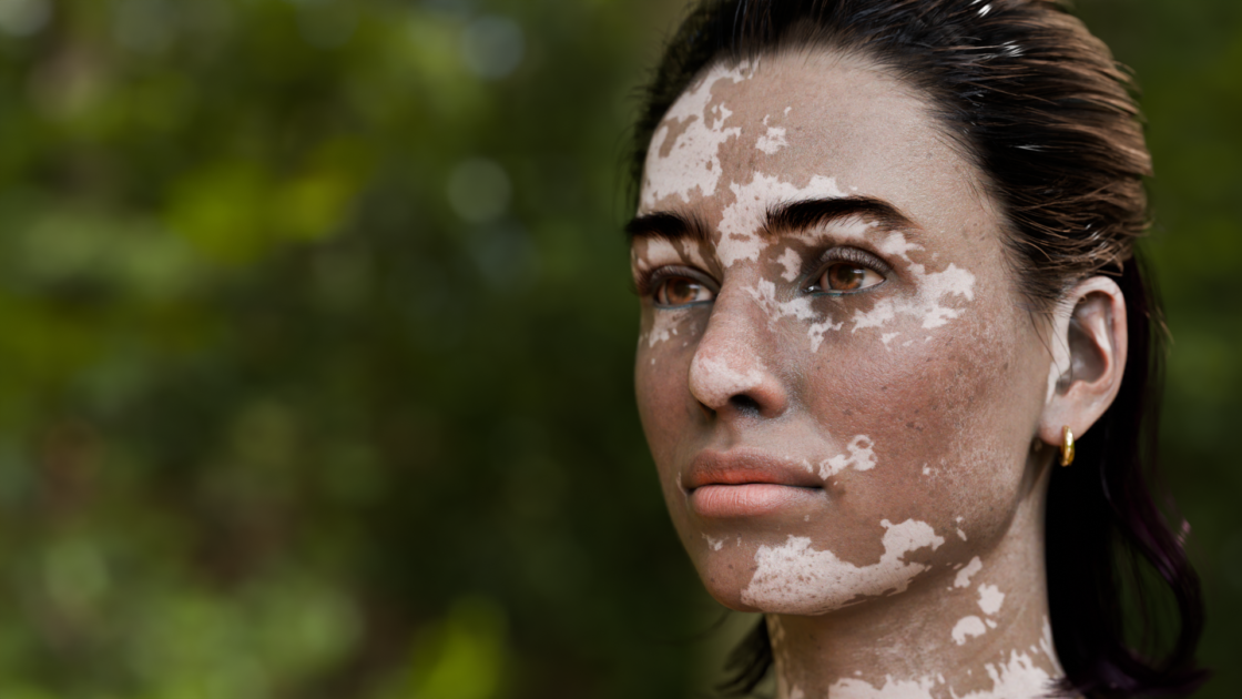 Realistic Skin Female